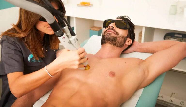Epilation laser definitive réalisée sur un homme par une esthéticienne Maelis