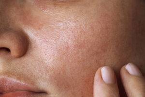 texture de la peau d'une femme au teint clair