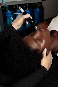 Application d’un soin Hydrafacial sur peau noire